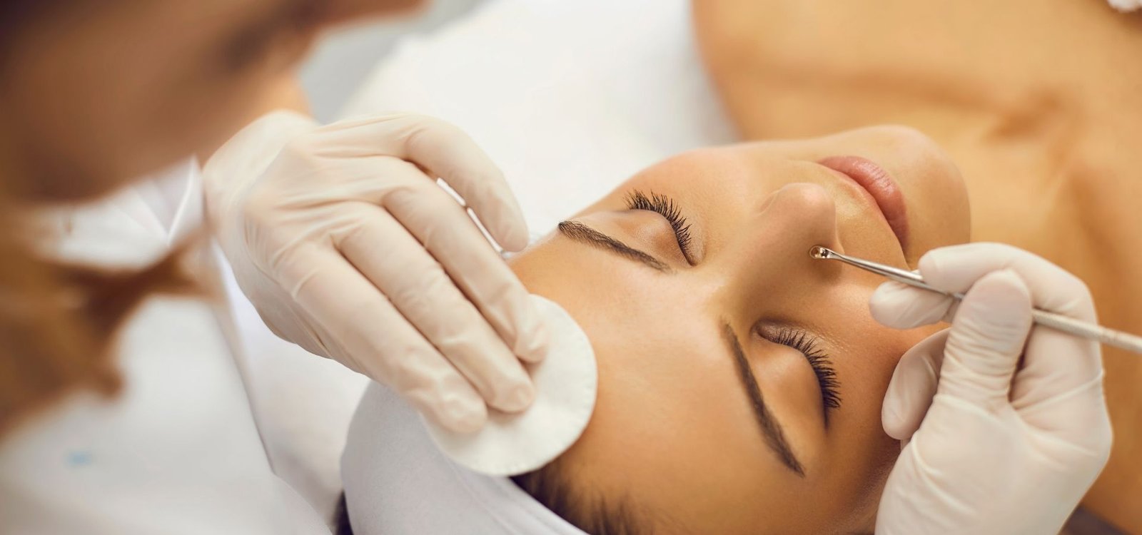 Tratamiento para piel grasa